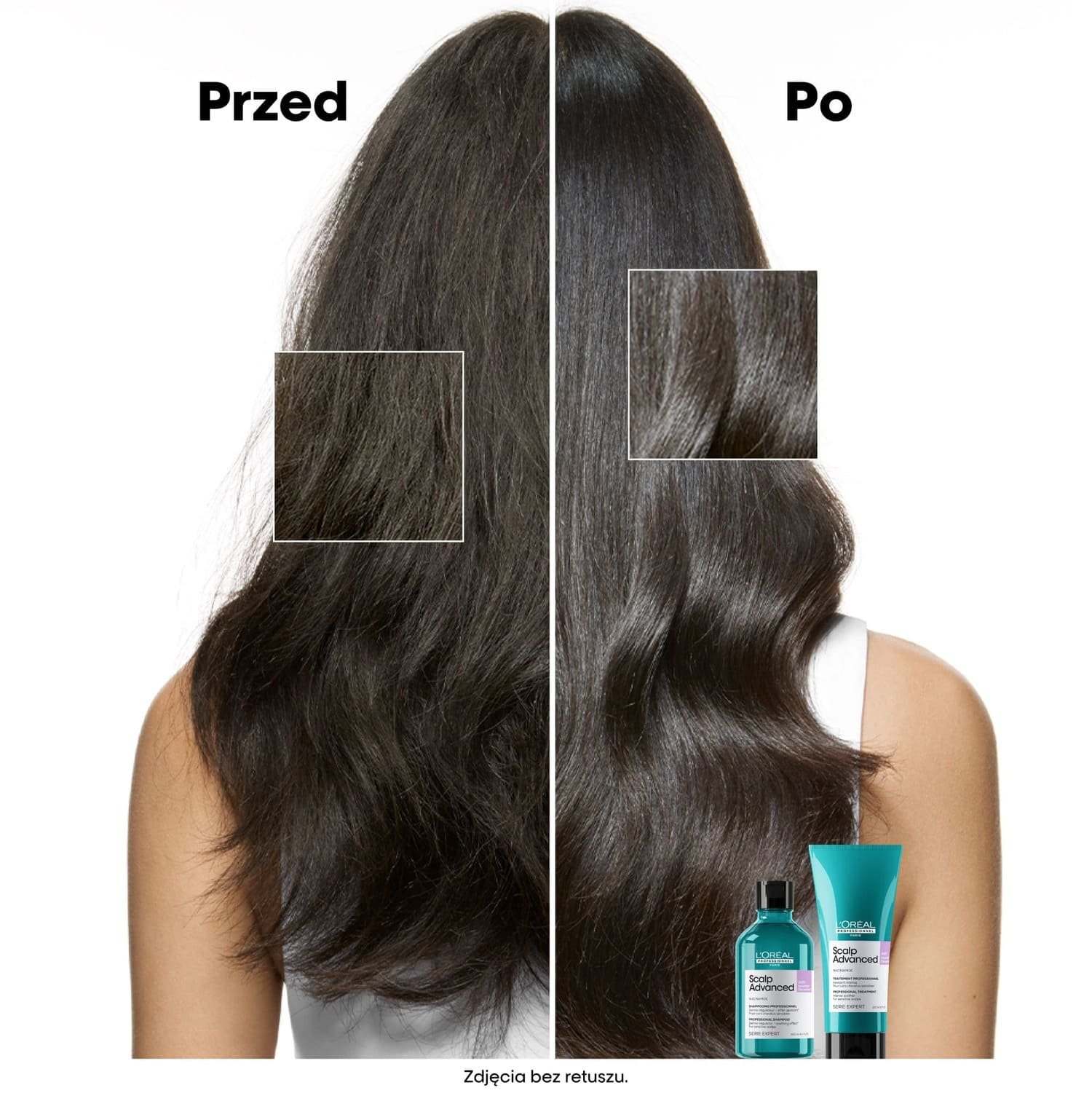 scalp-advanced-anti-discomfort-dermo-regulator-shampoo2
