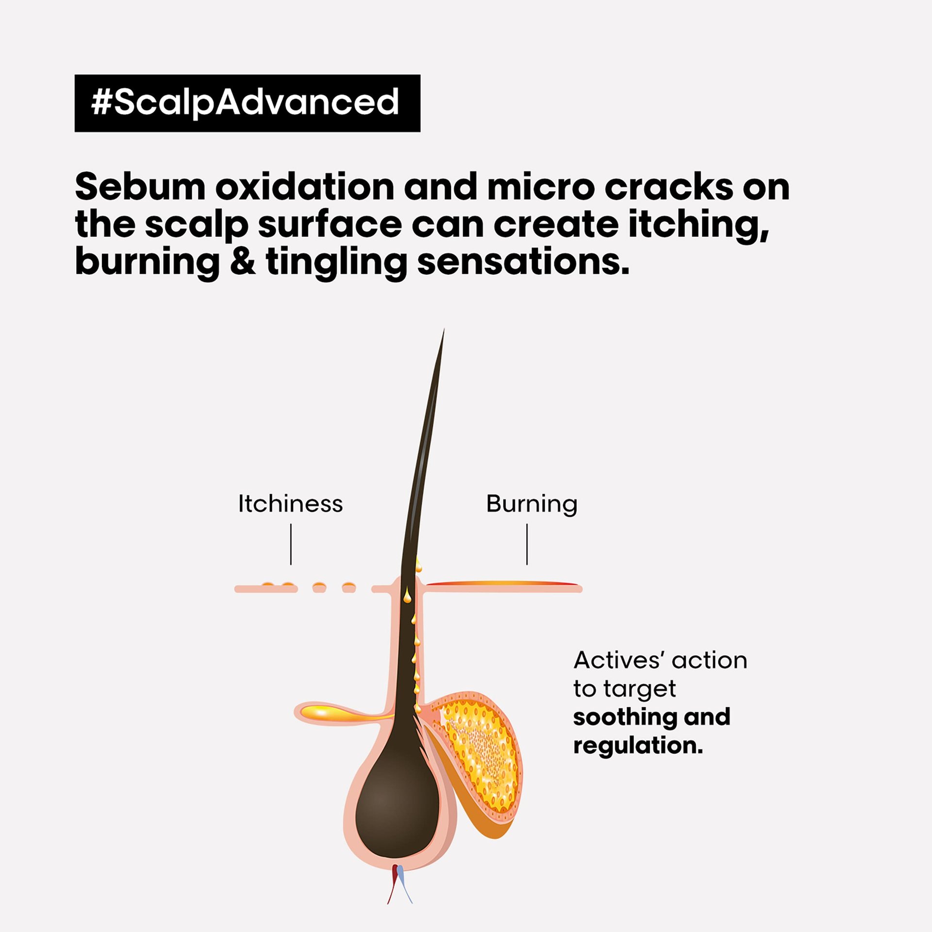 scalp-advanced-anti-discomfort-intense-soother-treatment8